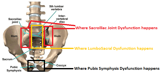 womens-health-sacro-iliac-joint-lumbosacral-pubis-symphysis-dysfunction