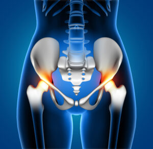 hip-labral-tears-hip-pain-causes