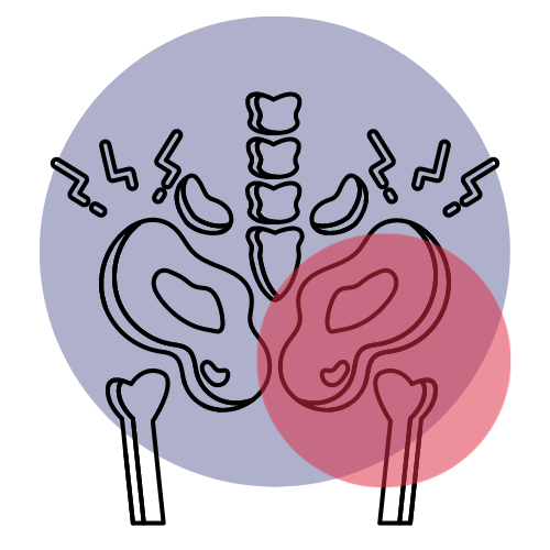 pelvic-pain-element