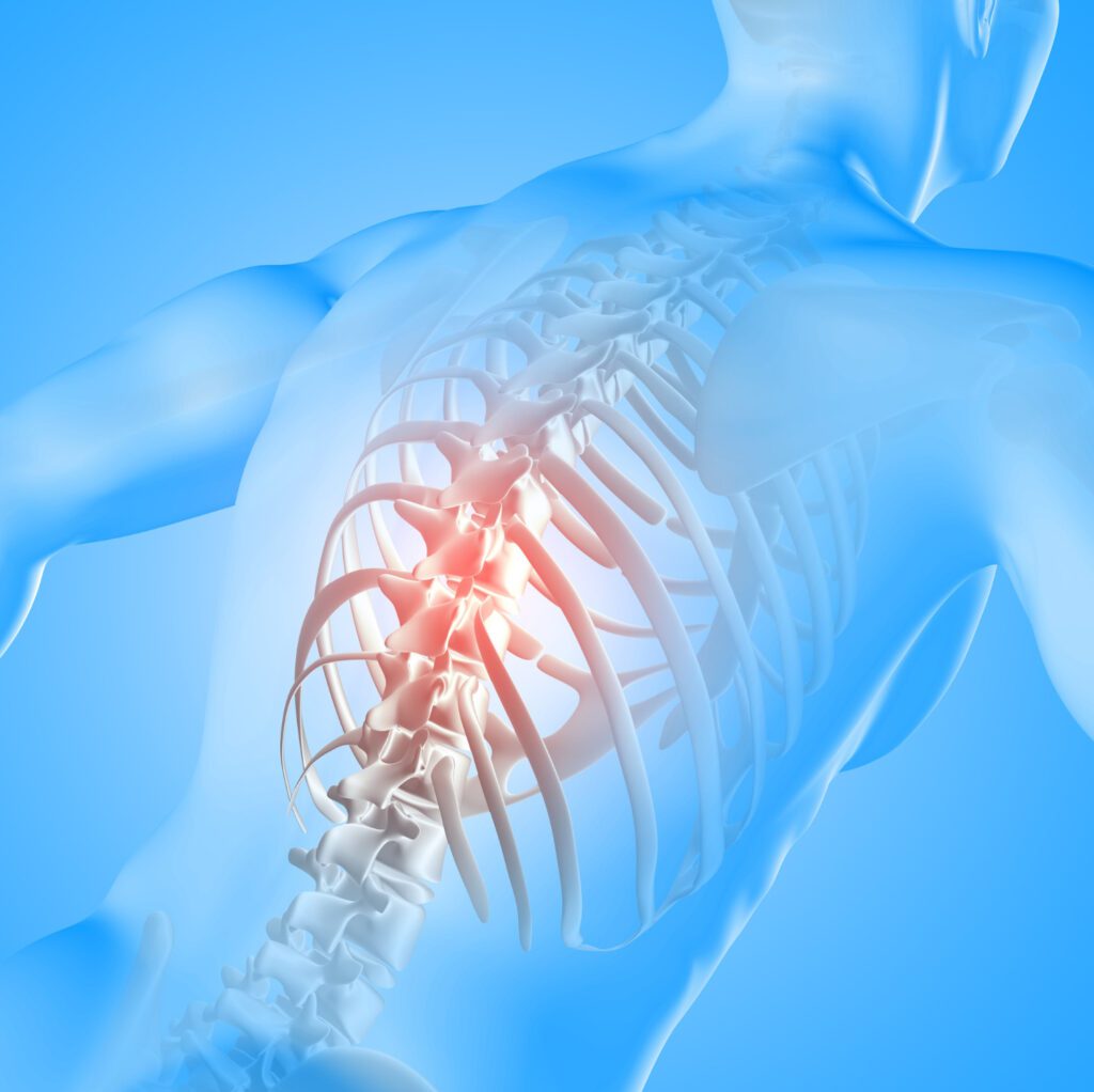 Assessing Back Pain