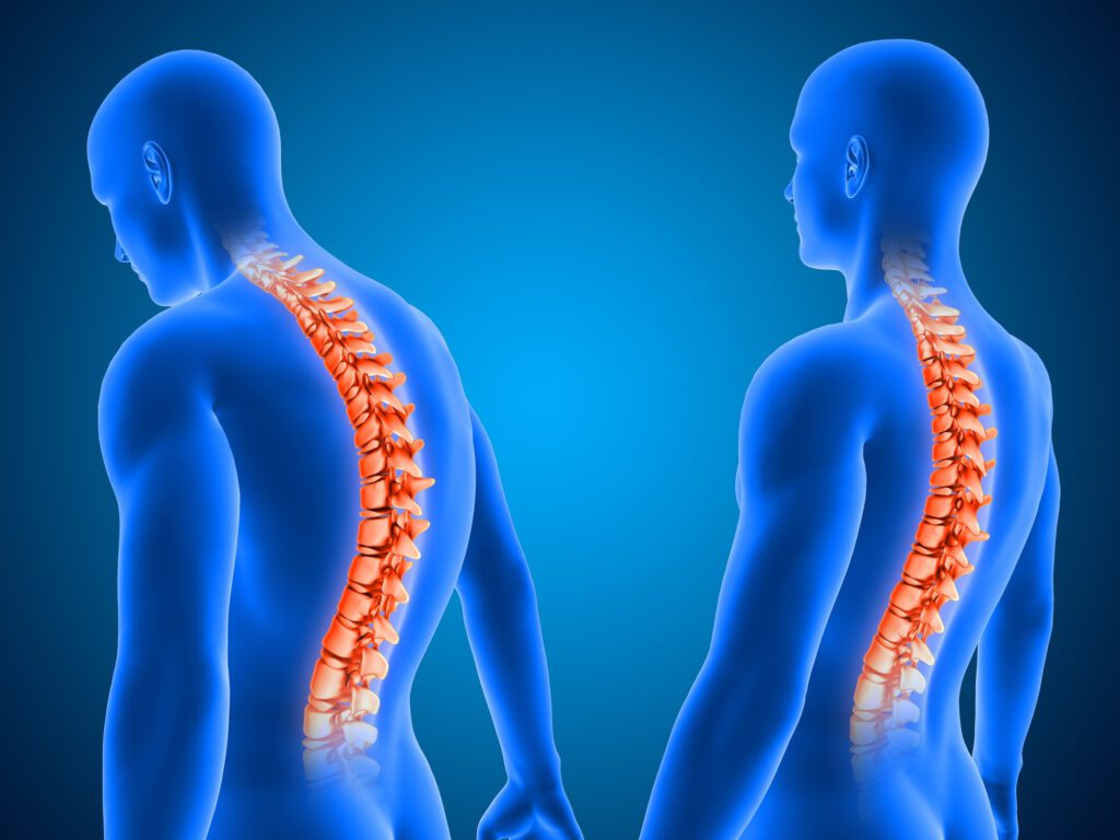 Physical Therapy for Back Pain Relief