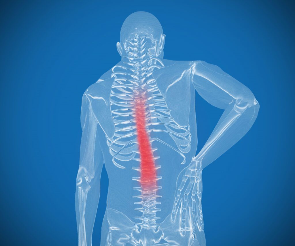 Physical Therapy for Stress-Related Back Pain