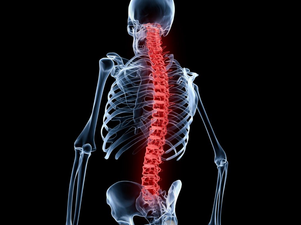 Strategies to Promote an Active Lifestyle on back pain spine