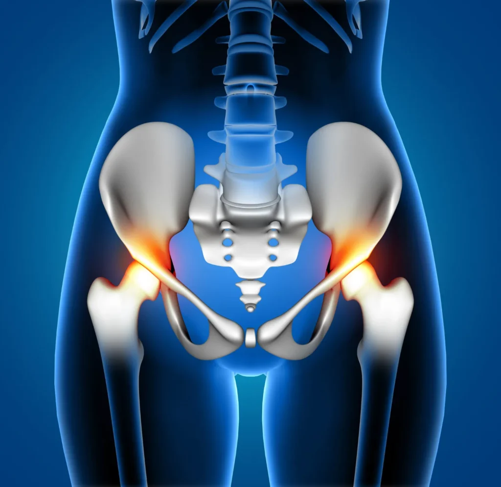 Ranked No.1 Hip Replacement Surgery Specialist in Dallas