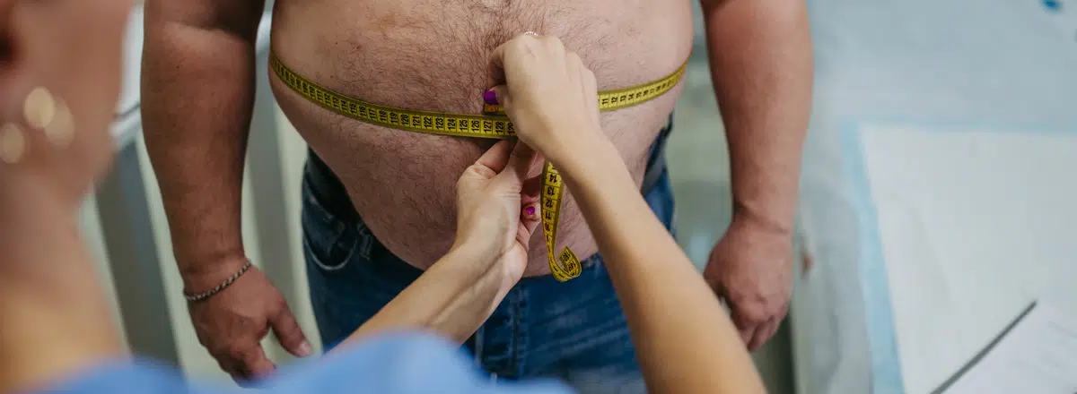 Obese-patient-being-measured