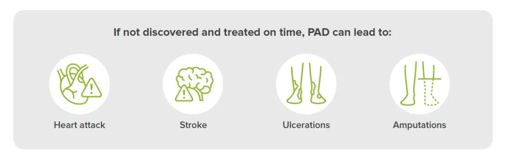 MESI-ABPI-MD_PAD-infographic